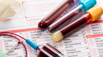 Blood samples are on a laboratory form for Finding out the blood values